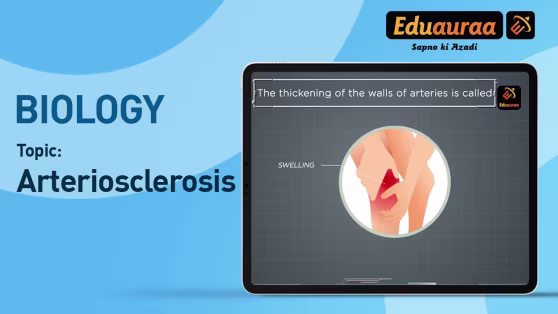 Arteriosclerosis