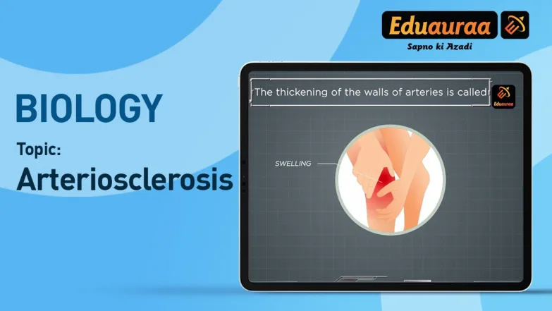 Arteriosclerosis 