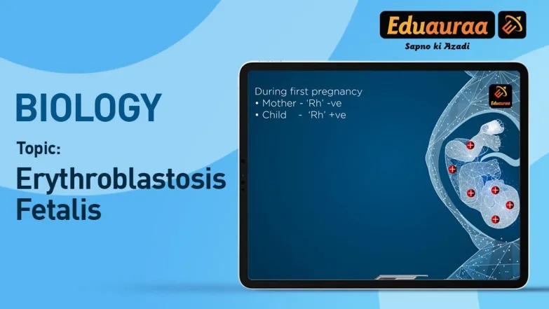 Erythroblastosis Fetalis 